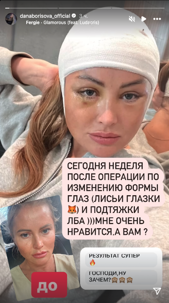 Неузнаваемая Борисова после пластической операции обратилась к россиянам Неузнаваемая Борисова после пластической операции обратилась к россиянам