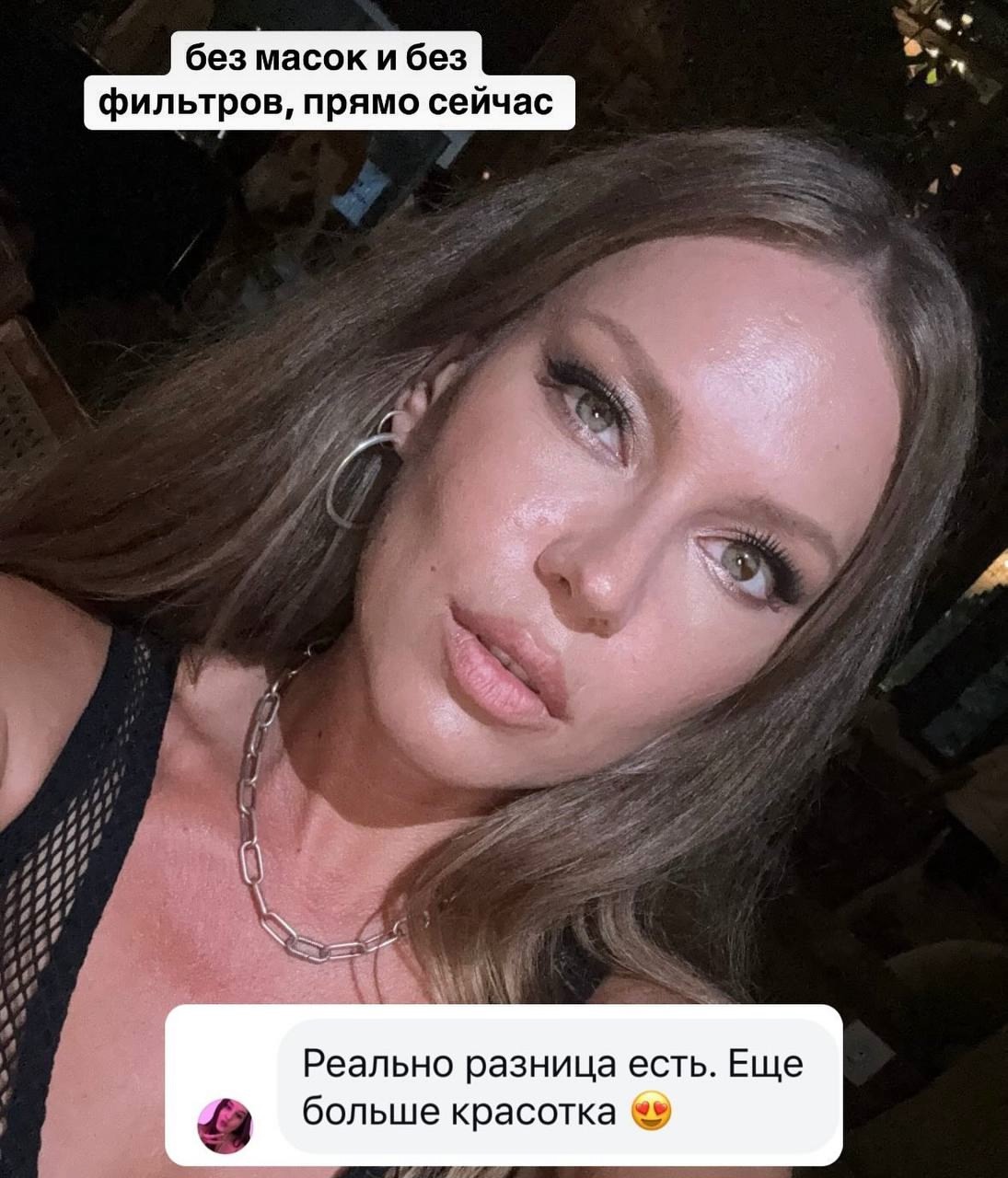 «Грыжи были сверху и снизу»: Рита Дакота радуется переменам на лице после пластики