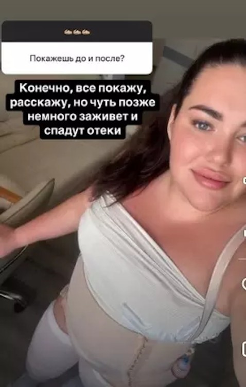 Дочка Пригожина показала фигуру после пластической операции Дочка Пригожина показала фигуру после пластической операции